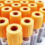 Pathology Sample Transport in Nigeria for Hospitals, Labs and Clinics