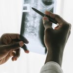 Mobile CT Scan Nigeria Services for Safer Medical Imaging Support