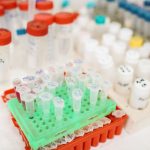 Hospital Gloves Suppliers Nigeria for Clinics, Hospitals and Medical Buyers